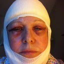 Clean bandages day after surgery
