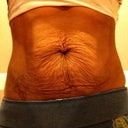 Tried to pulled it in :( All that skin gotta go --->