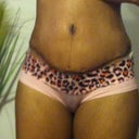 19 days post op and swollen. My hips too