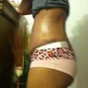 Lower ab and back still swollen. I use a lot of bio oil