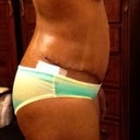 Right side still swollen