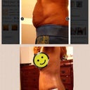 Pre-op vs 3wks post op