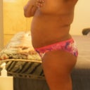 Before pic 1 week pre op