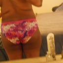 Before Pic 1 week pre op