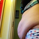 pre op
