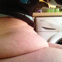 pre op lap fat