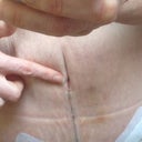 This is where my belly button is hiding. 2 weeks. PO.
