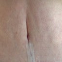 4 weeks PO, tummy button in its crease