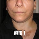 Week 1