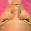 Chemical Peel