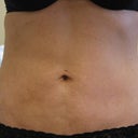 Lipotherme