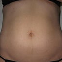 Lipotherme