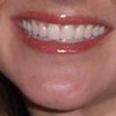 Full Lip