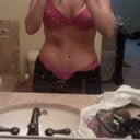2 years post op