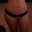 2 months after smart lipo