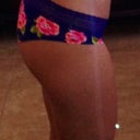 2 months after smart lipo