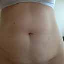 Before pic of tummy - may look better than it is
