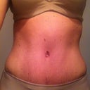 1 month PO