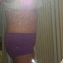 side view 4 weeks post op