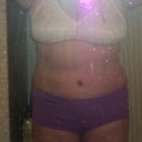 front on view 4 weeks post/evening swollen some