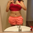 16 weeks post op, hope to see more improvment in the flanks