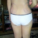 Really swollen but better then before po day7