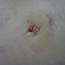 new belly button po day 7