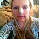 3 Days after surgery - - - the Monday after my Friday surgery...face is a little puffy with a twinge of bruising, but, not much...HAVE NOT WASHED MY HAIR SINCE FRIDAY MORNING BEFORE THE SURGERY!!!  ICK!!  :-)