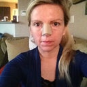 2 Days after surgery - Sunday after Friday's procedure...
