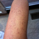Left Thigh