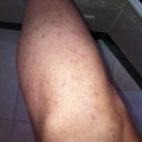 Left Thigh