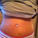 2 weeks post op...cotton ball in my belly button because it feels weird without it.