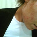 my face