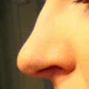 Pre-Op. Big honkin nose with a slight bump.