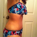 11 wks post op in my new bikini :)