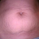 pre-op