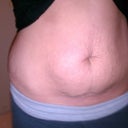 pre-op