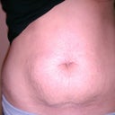 pre-op