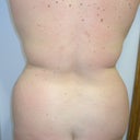 before 2-16-11 back view