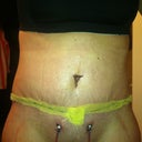 PO Day 5 - These drain holes are PAINFUL! - still a bit swollen