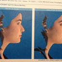 Simulated before n after