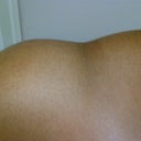 from bra straps