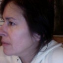 Before: right side view