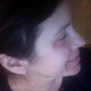 After: nose tip