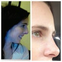 Before and after