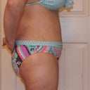 day 10 bikini side view....right side forgot to get 1 of left,oh well