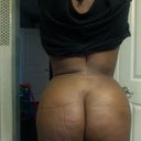 Very swollen and stiff best I could do right now.