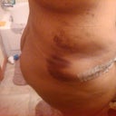 swole n bruised
