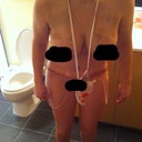 2 days post op