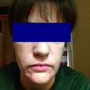 This is one of the "before" pictures. I have makeup on, unfortunately.